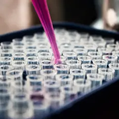 Różowa pipeta pobiera próbkę do jednego z wielu probówek w stojaku. To kluczowy etap w badaniach histologii.
