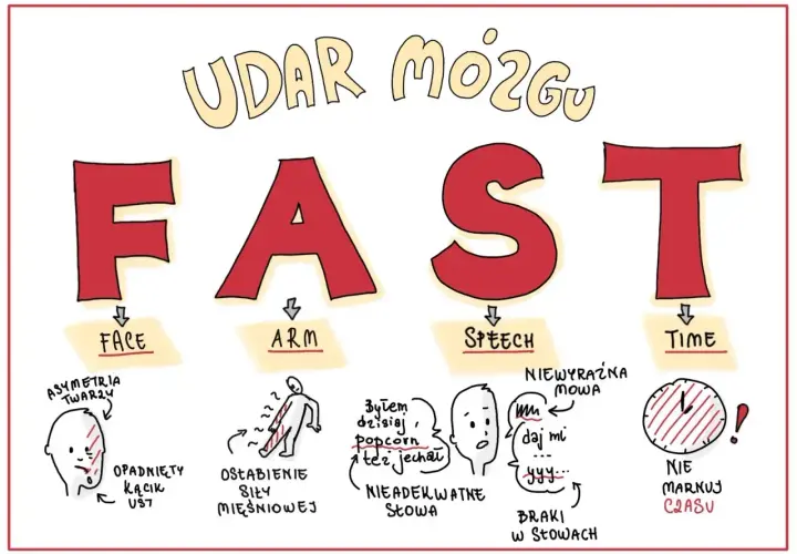 Objawy udaru mózgu: FAST. Asymetria twarzy, osłabienie siły mięśniowej, nieadekwatne słowa, braki w słowach, niewyraźna mowa, nie marnuj czasu. Czasownik to czynność, np. "daj mi".